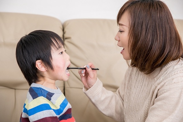 お子さまのむし歯予防について